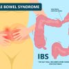 What-is-Irritable-Bowel-Syndrome homeopathy treatment.jpg