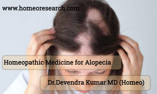 homeopathic medicine alopecia