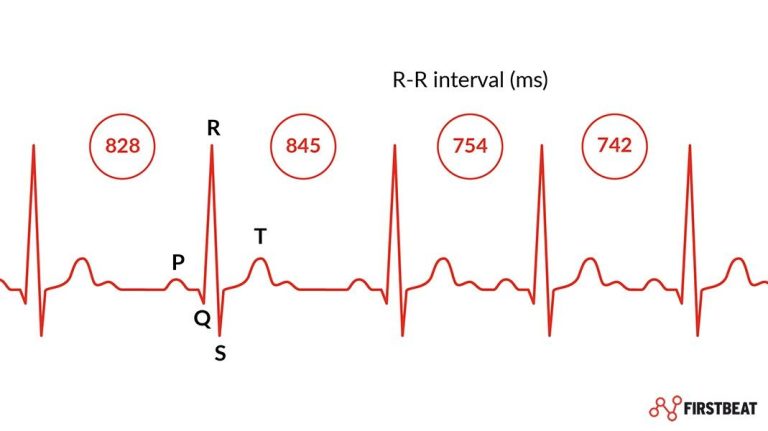 Heart Rate Variability (HRV) – A Primer for Homoeopaths